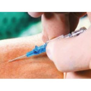 CATHETER IV INTROCAN-SAF WING - 425357402
