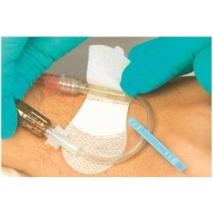 DEVICE  CATHETER  GRIP  ADHESIVE - 3300M